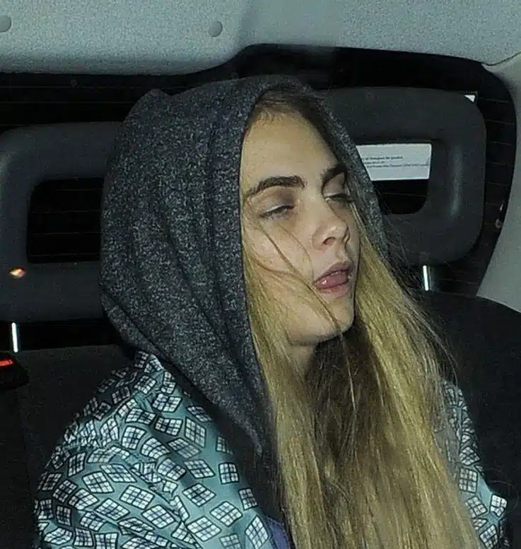 Cara Delevingne Showing The Other Side Of Supermodels